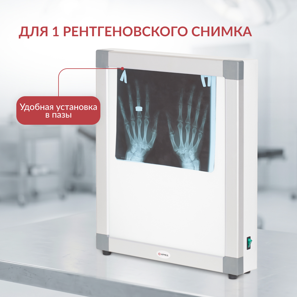 НЕГАТОСКОП общего назначения Armed 1-кадровый (-)